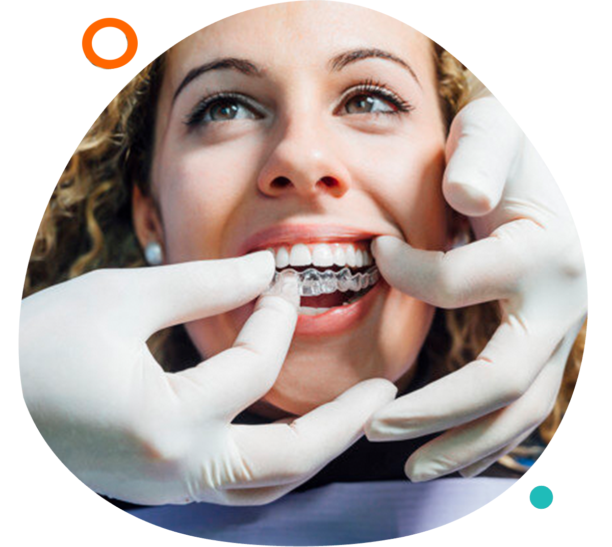 Dental-Family-service-Invisalign-treatment